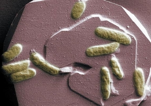 Shewanella oneidensis, проводящие на оболочках клеток микробы (space.com) Shewanella oneidensis, проводящие на оболочках клеток микробы (space.com)
